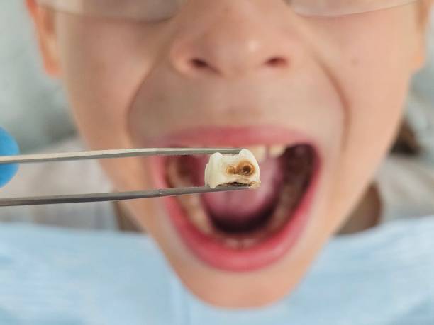 Best Emergency Orthodontic Services in Rock Port, MO